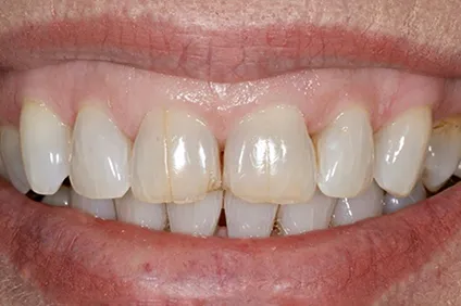 get a perfect smile from Dentist Arcadia - before